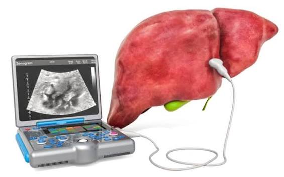 liver-ultrasound-when-it-may-be-used-body — liver cirrhosis nodular surface portal hypertension splenomegaly ascites