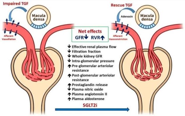 pain relievers and kidney safety — acetaminophen versus NSAIDs kidney risk for people with CKD