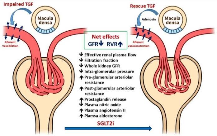 pain relievers and kidney safety — acetaminophen versus NSAIDs kidney risk for people with CKD