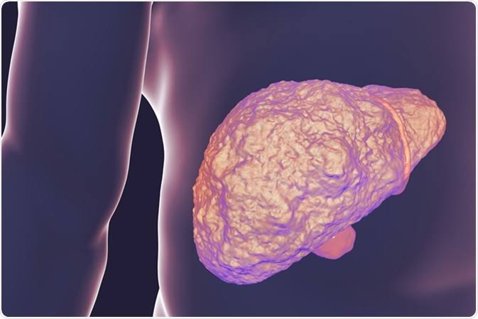 pale-stool-and-liver-or-bile-problems-body — MRCP imaging and liver function tests for biliary obstruction diagnosis