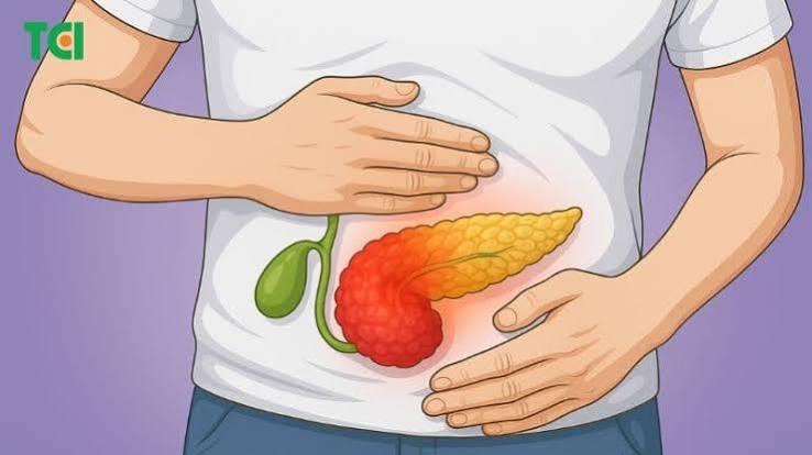 pancreatitis chronic pancreas digestive enzymes EPI malabsorption steatorrhoea fecal elastase PERT treatment