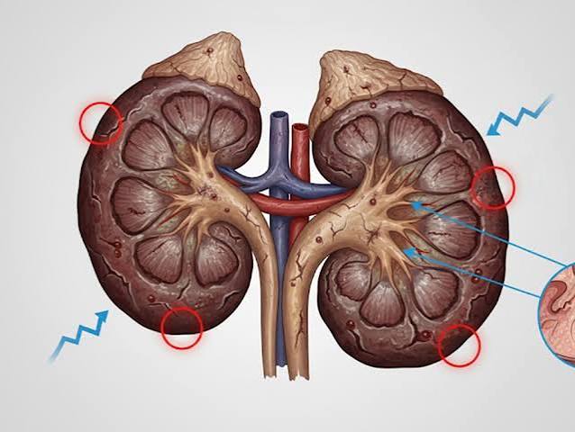 low-phosphorus foods for kidney health including egg whites, fresh fruits and vegetables