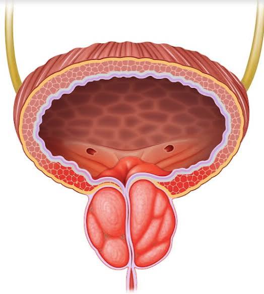 prostate health and urinary symptoms — anatomical diagram showing prostate gland location relative to bladder and urethra, with BPH urethral compression illustrated