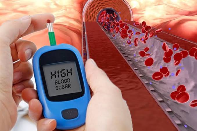 diabetic kidney disease diet protein restriction sodium exercise lifestyle management