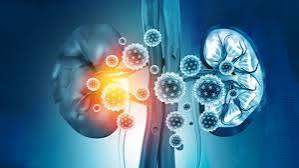 questions to ask about chronic kidney disease — CKD patient with written question list during a nephrology appointment
