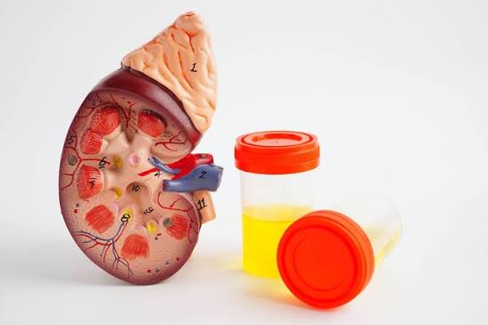 slowing kidney disease progression medication lifestyle SGLT2 inhibitor RAAS blockade