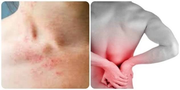 stage 3 CKD anemia metabolic acidosis secondary hyperparathyroidism hyperkalemia treatment