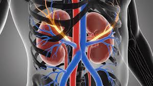 stage 4 CKD kidney replacement therapy options hemodialysis peritoneal dialysis transplant