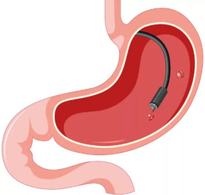stomach pain needs evaluation alarm features appendicitis pancreatitis emergency