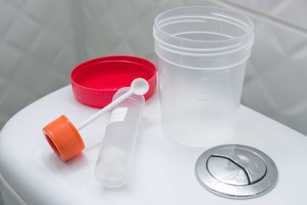 stool tests for digestive health — faecal occult blood calprotectin H pylori colorectal cancer screening