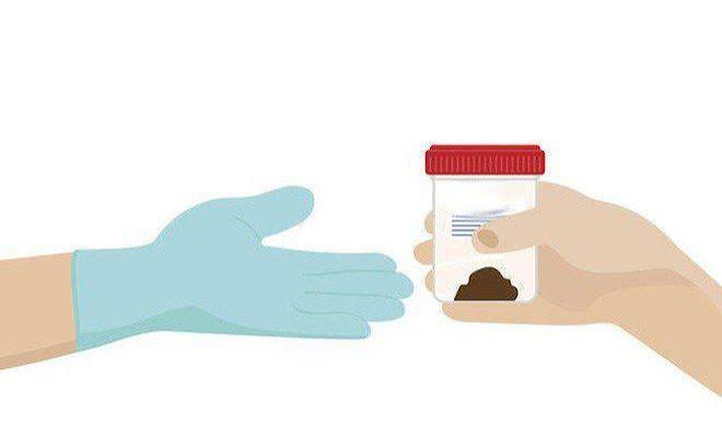 stool-tests-for-digestive-health-body — stool calprotectin inflammatory bowel disease IBD Crohn's ulcerative colitis
