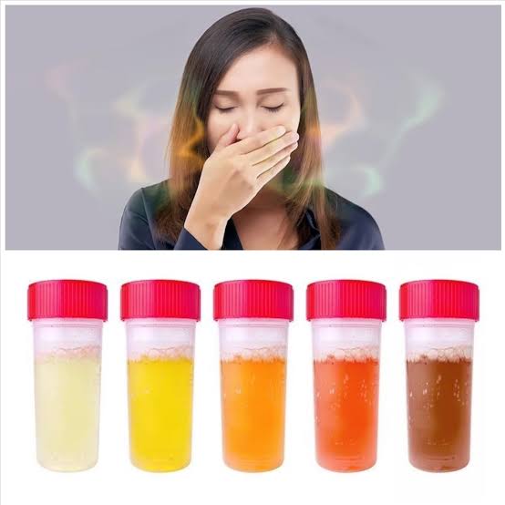 strong smelling urine dehydration diet infection metabolic causes