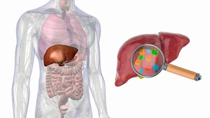 support-liver-health-lifestyle-body — Mediterranean diet aerobic exercise MASLD NAFLD liver improvement weight loss