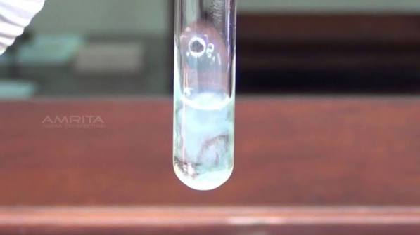 urine albumin test result showing ACR value for kidney disease screening