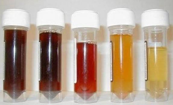 urine color chart what adults should know complete guide