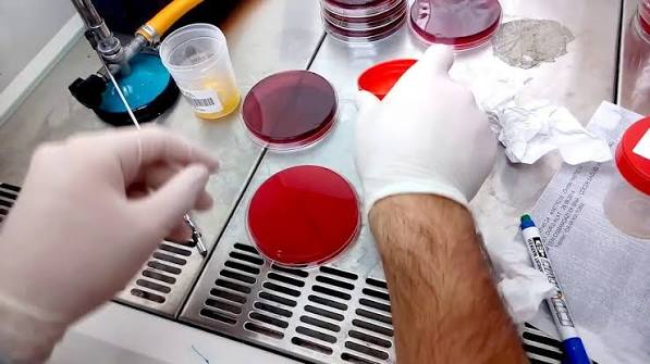 Urine culture results showing E. coli colony count antibiotic susceptibility report sensitive and resistant antibiotics
