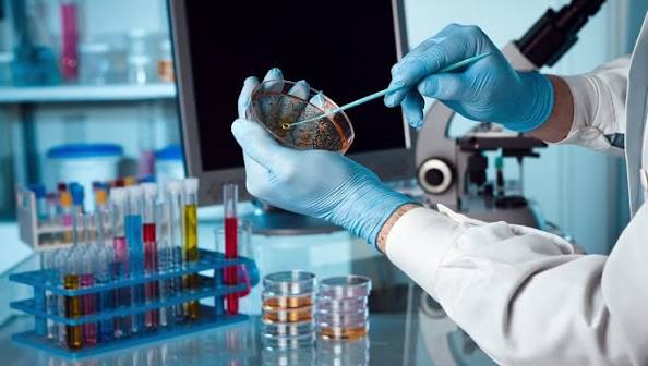 urine culture UTI diagnosis — laboratory setting showing urine sample collection and culture plate used to identify bacteria and sensitivity for UTI antibiotic selection