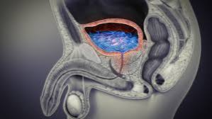 UTI in men — anatomy diagram showing the male urinary tract with the longer urethra that provides greater protection against ascending bacterial infection