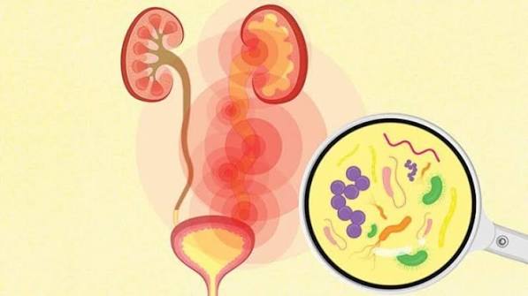 UTI symptoms in adults — adult patient discussing urinary discomfort symptoms with a doctor during a clinical visit