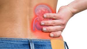 UTI vs kidney infection comparison — diagram showing bladder infection confined to lower tract versus pyelonephritis involving kidney with fever and flank pain