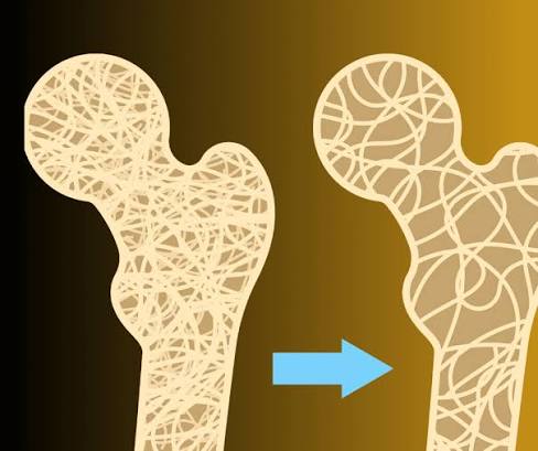 Bone health numbers every adult should know — featured image showing DEXA scan T-scores calcium vitamin D reference values