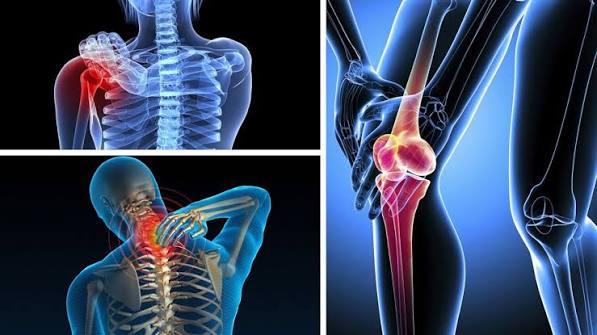 Common bone joint and muscle problems in adults including osteoarthritis osteoporosis back pain and inflammatory arthritis