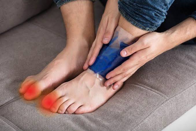 Gout flare-up triggers illustrated — the NLRP3 inflammasome mechanism, dietary purine sources including beer and red meat, and urate crystal dissolution when starting urate-lowering therapy