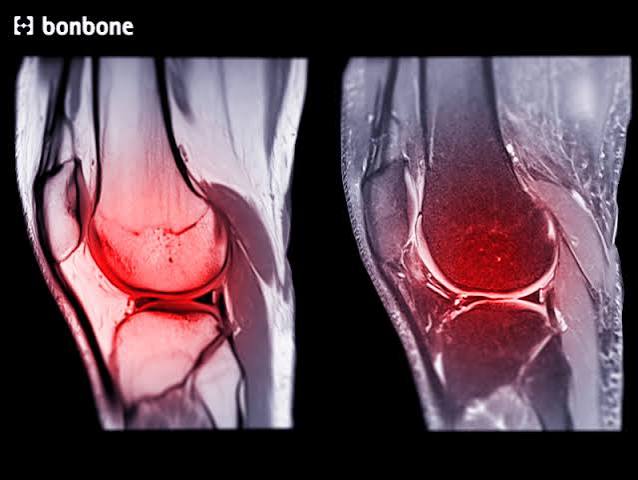 How bones joints and muscles work together in the musculoskeletal system showing lever mechanics and joint stabilization