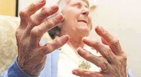 Morning joint stiffness what it may indicate — person holding stiff hands on waking suggesting rheumatoid arthritis or osteoarthritis