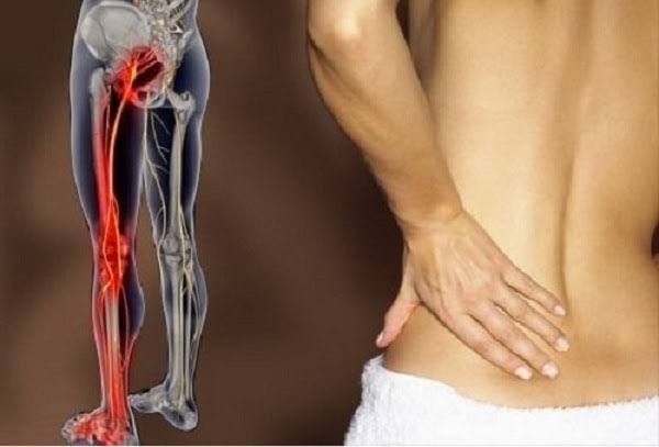Pain that travels down the leg — illustration showing sciatica nerve compression from lumbar disc herniation with radiation down the posterior leg, alongside vascular and referred pain pathways