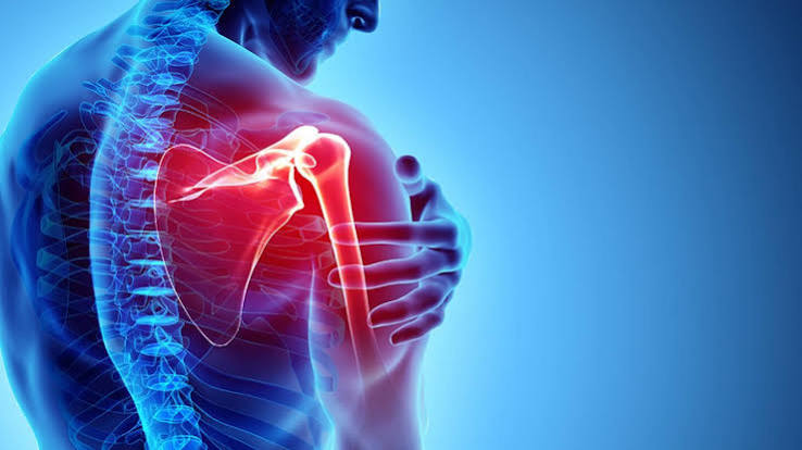 Pain that travels down the arm — illustration showing cervical nerve root compression from disc herniation and cardiac pain radiation patterns from ischaemia to the left arm