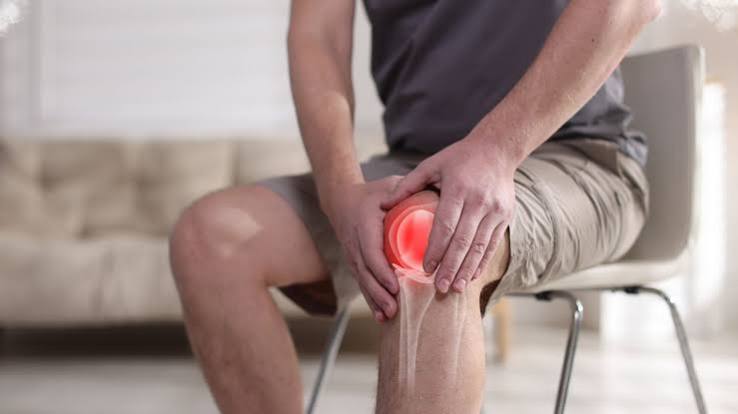 Knee osteoarthritis — illustration of the knee joint showing medial compartment cartilage loss, osteophyte formation, subchondral sclerosis, and joint space narrowing on X-ray characteristic of knee OA