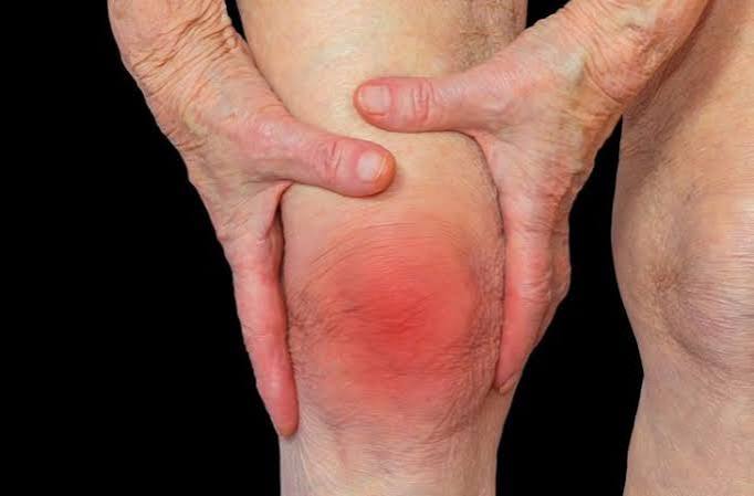 Rheumatoid arthritis symptoms and diagnosis — illustration showing symmetrical MCP and PIP joint swelling, ulnar deviation, and morning stiffness characteristic of RA