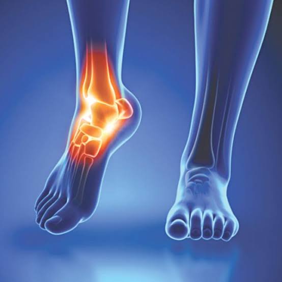 Foot and ankle pain what it may mean — person holding foot in pain suggesting plantar fasciitis or ankle sprain assessment