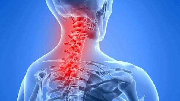 Neck pain common causes and self care basics — featured image showing cervical spine anatomy disc herniation and postural strain