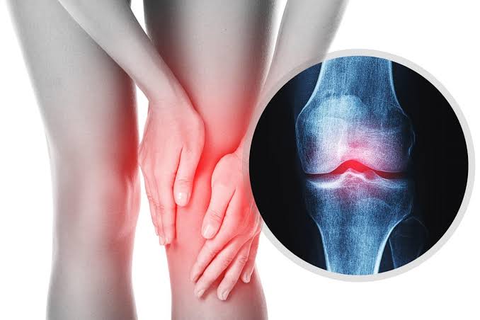 Signs of healthy bones and joints — featured image showing functional indicators of musculoskeletal health in adults