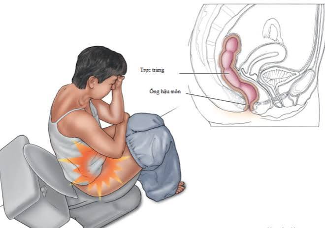 Person taking a standing break from desk work to counteract the digestive symptoms caused by sitting too long, stretching and moving