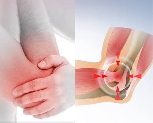 Tendinitis common sites illustration showing inflamed tendons at the Achilles heel, supraspinatus shoulder, lateral epicondyle elbow, patellar knee, and first extensor compartment wrist with redness and swelling at each location
